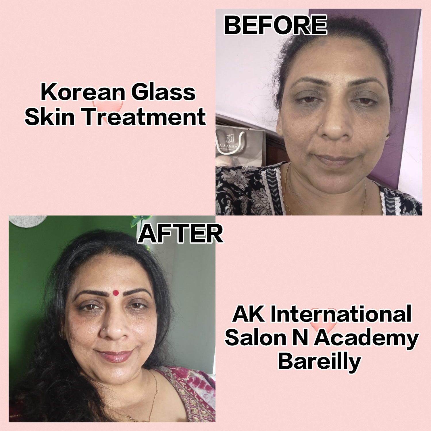 Korean Glass Skin Treatment Kya Hai?